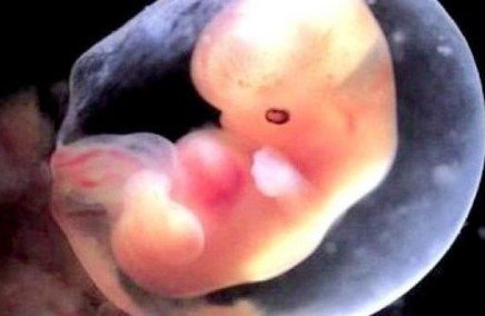 recherche sur embryon.jpg