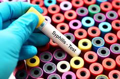 syphilis _ Latest News _ New York Post.jpg